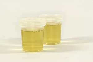 urine in a container