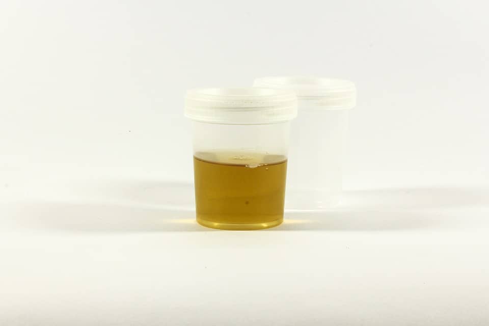 a sample of synthetic urine